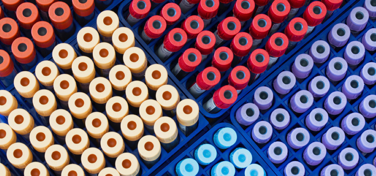 Big Data: Prescription for the Pharmaceutical R&D Plight