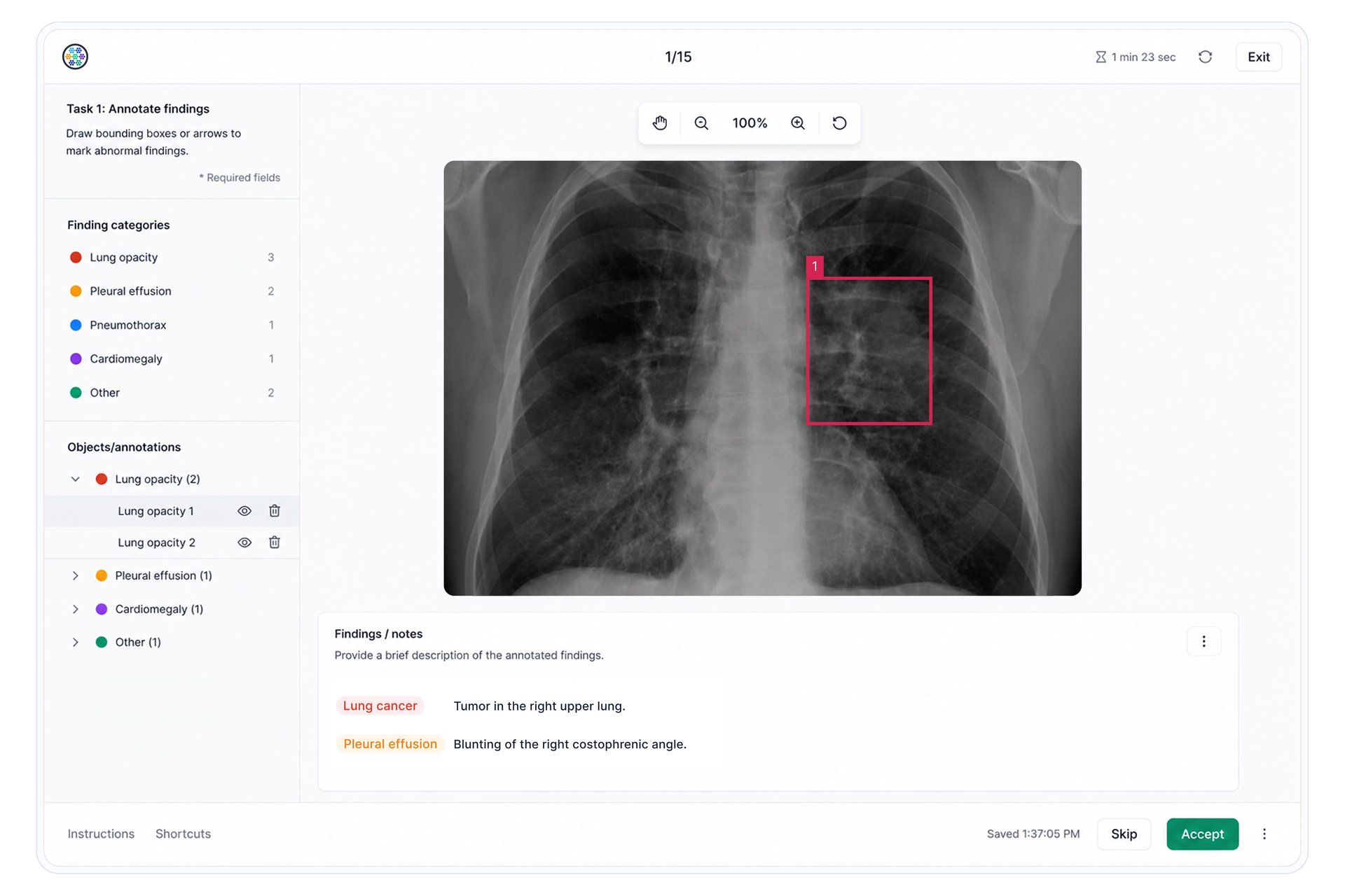 Radiology Image Finding Verification