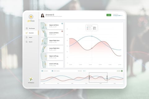 Profusa Sensor | Data Portal project