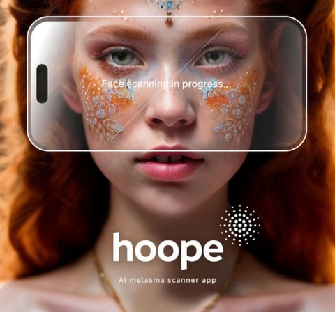 AI Melasma Scanner App and Desktop Dashboard project
