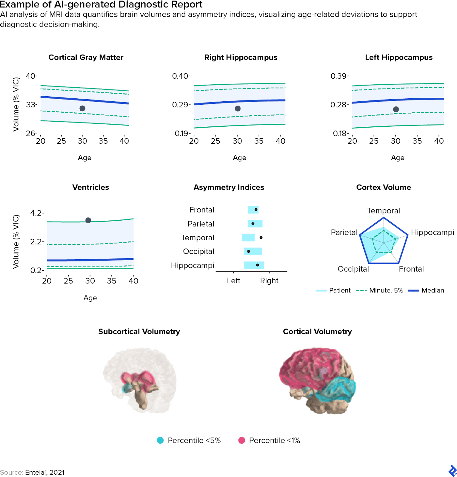 Brain asymmetry and volume analysis with imaging AI, showing 3D reconstruction, age-related volume trends, and percentile-based subcortical and cortical volumetry
