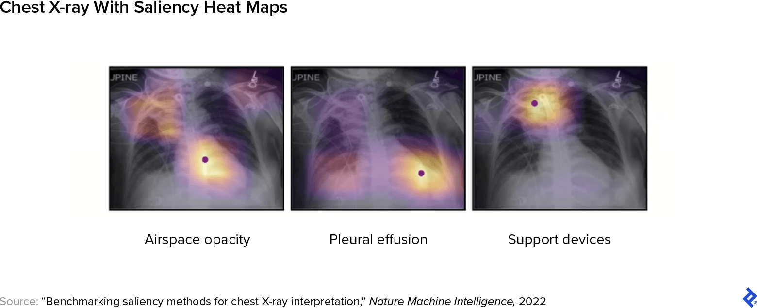 Chest X-ray images using saliency methods, showing heat maps highlighting anomalies linked to airspace opacity, pleural effusion, and support devices.