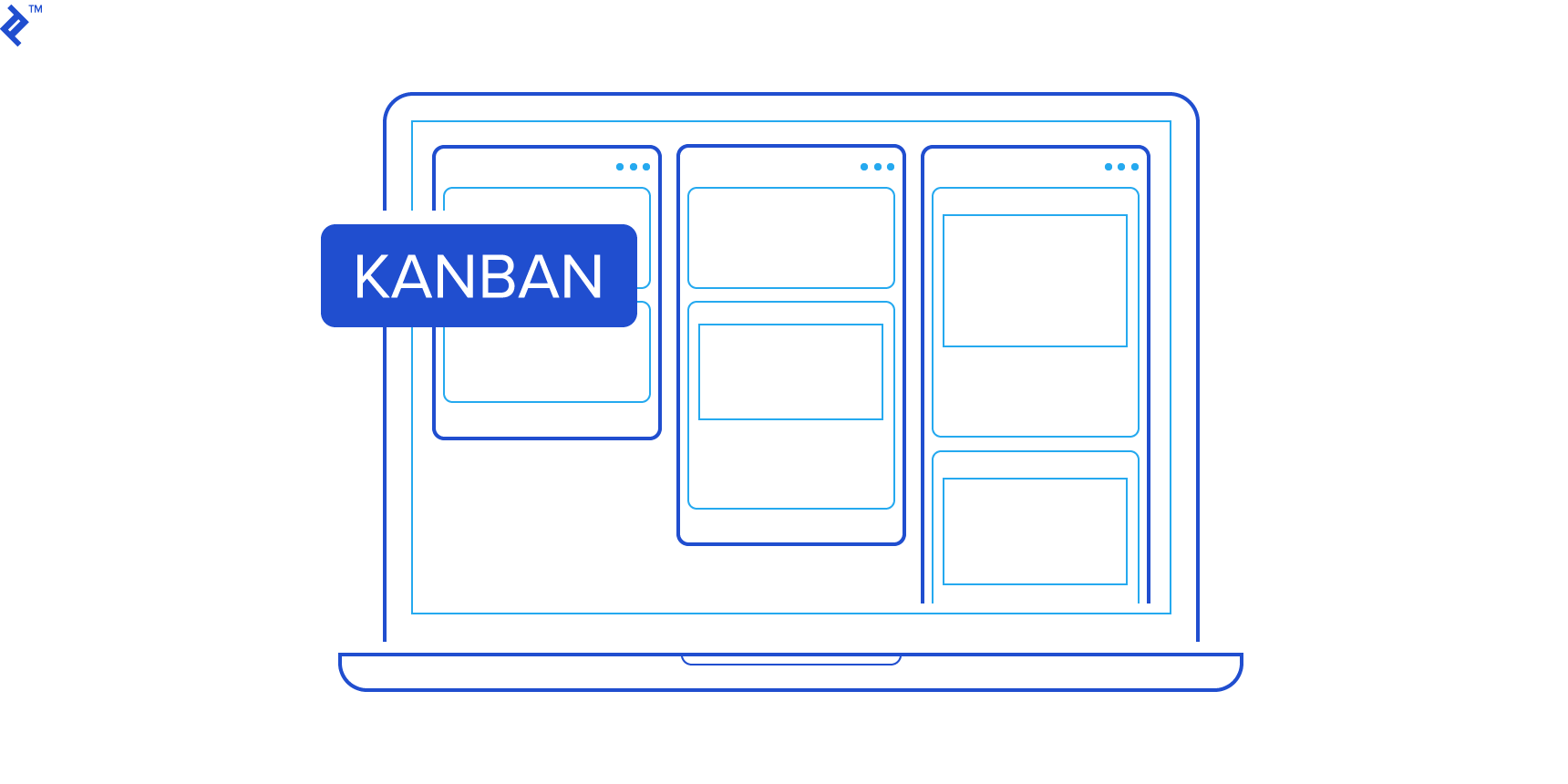Kanban boards help visualize the workflow.