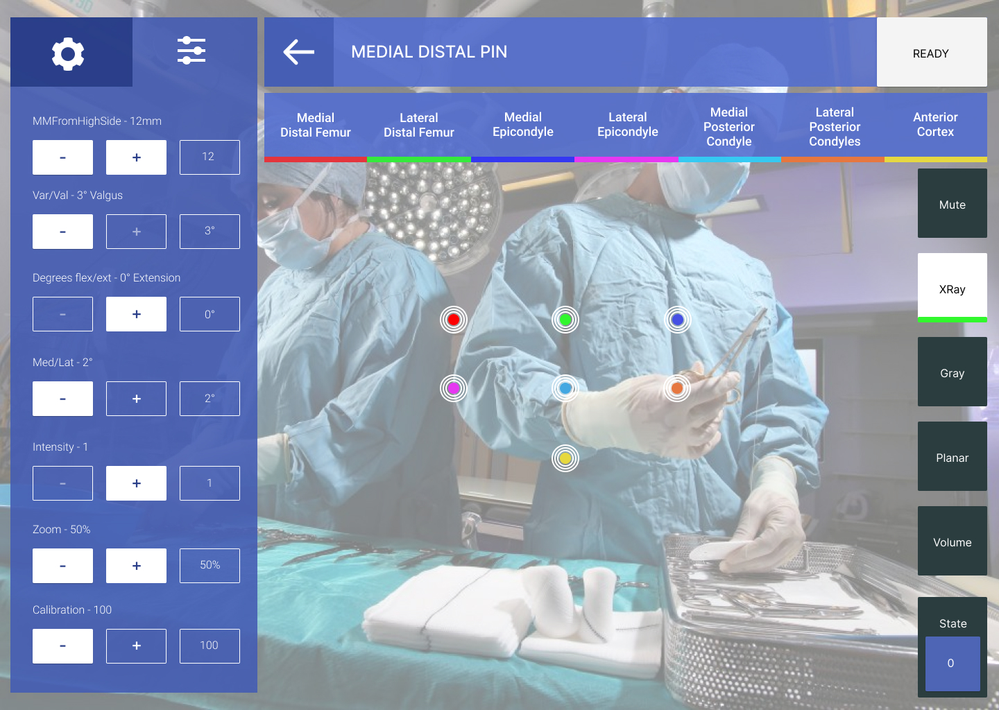 With the HoloLens, this medical application overlays the surgeron’s view with information that can help them choose where to make incisions, for example.